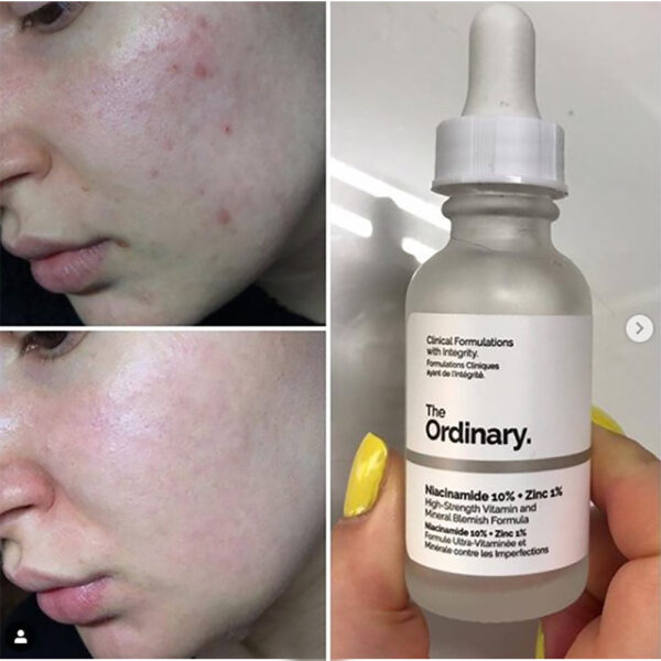 The Ordinary ™ Niacinamide 10% + Zinc 1%