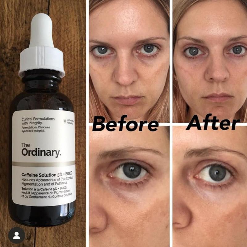 The Ordinary™ Caffeine Solution 5% + EGCG