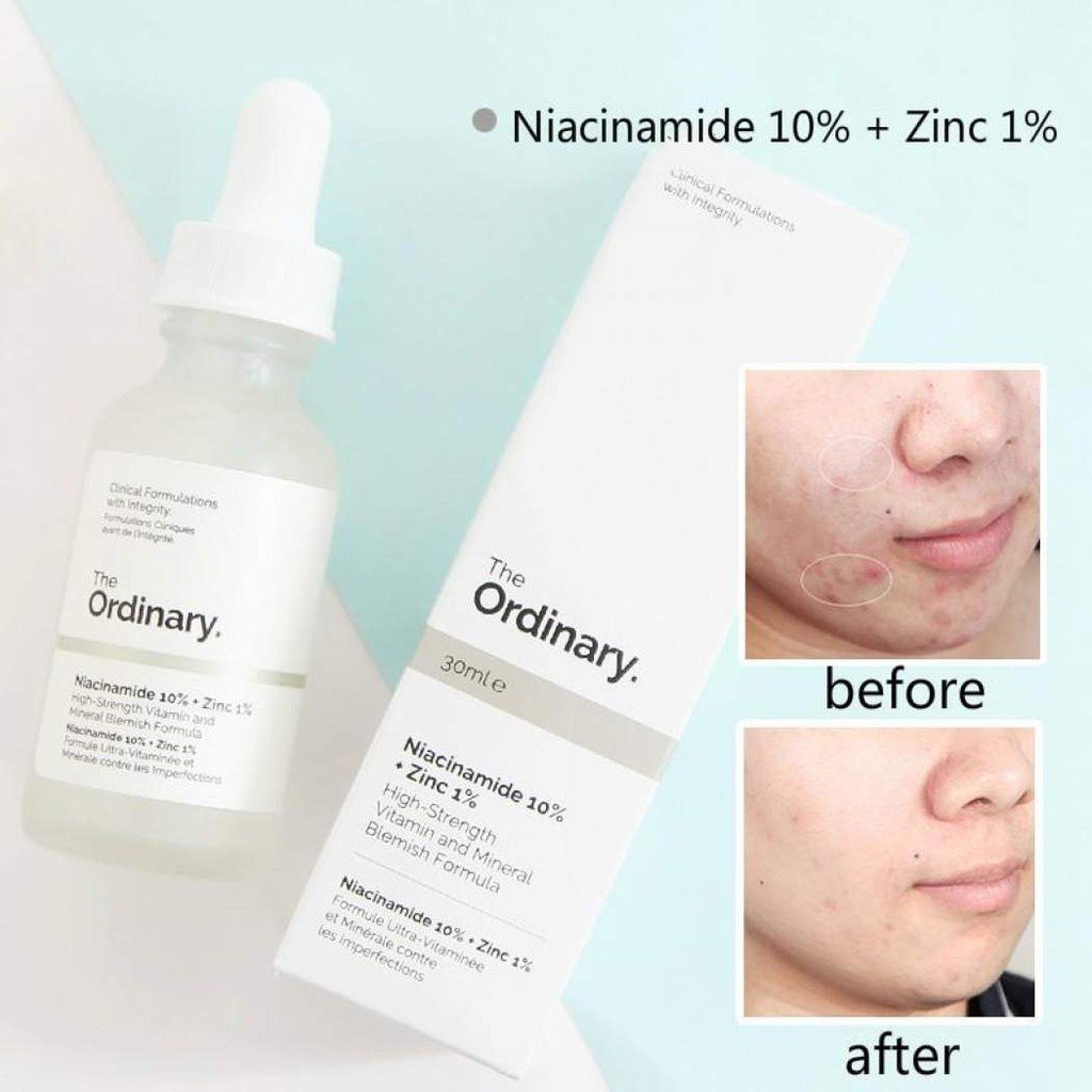 The Ordinary Niacinamide 10 Zinc 1 Kashi shop The Ordinary Niacinamide 10 Zinc 1 Kashi shop